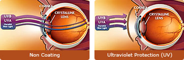 Ultraviolet Protection (UV)