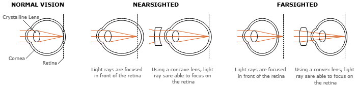 Spherical (SPH)